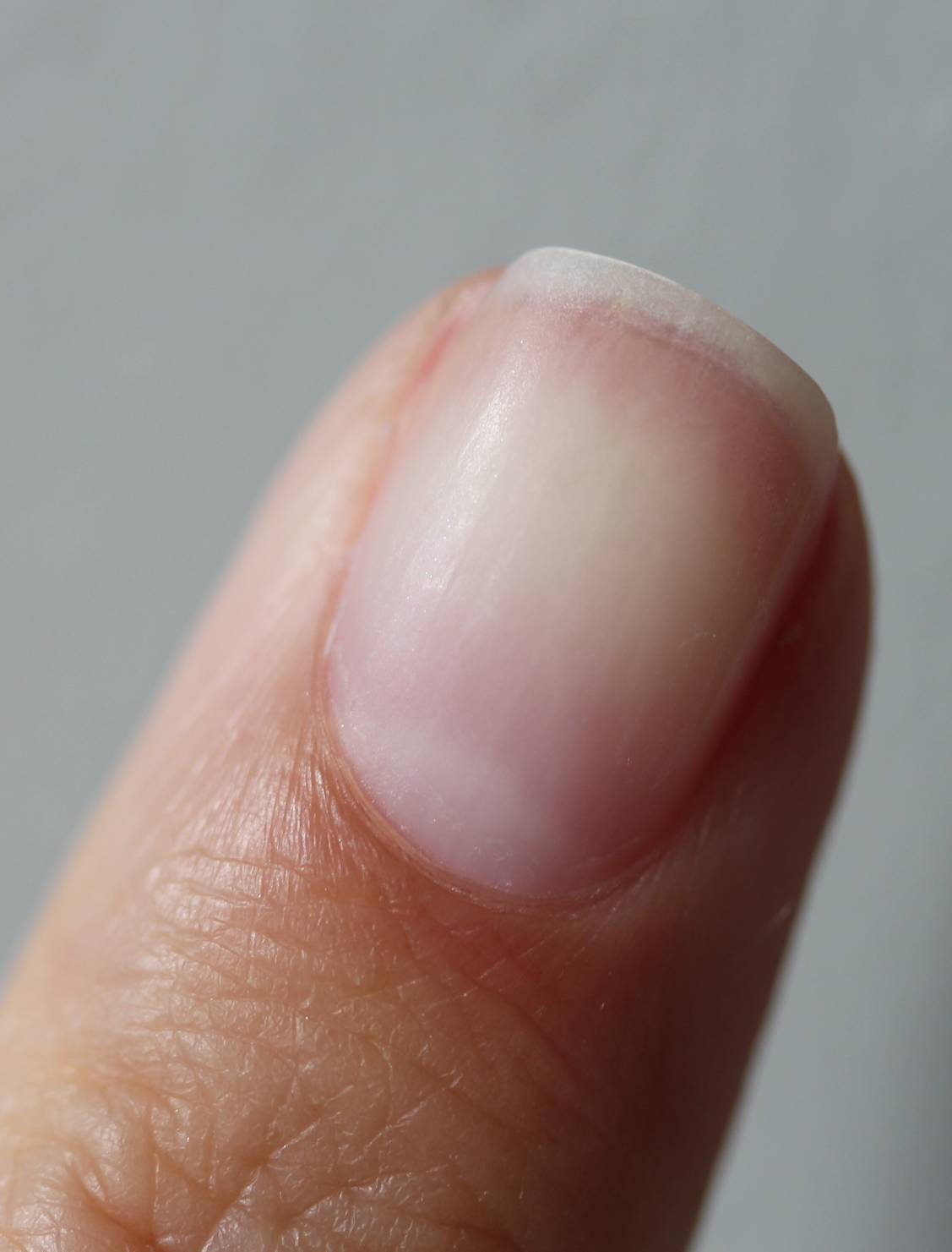 Acetone Additive